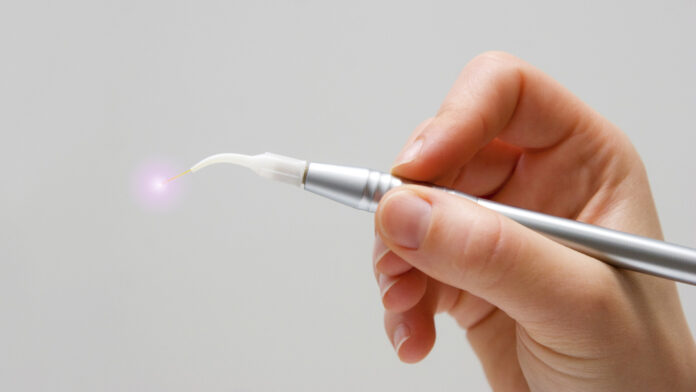 Root Canals