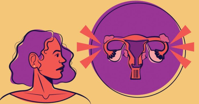 Endometriosis